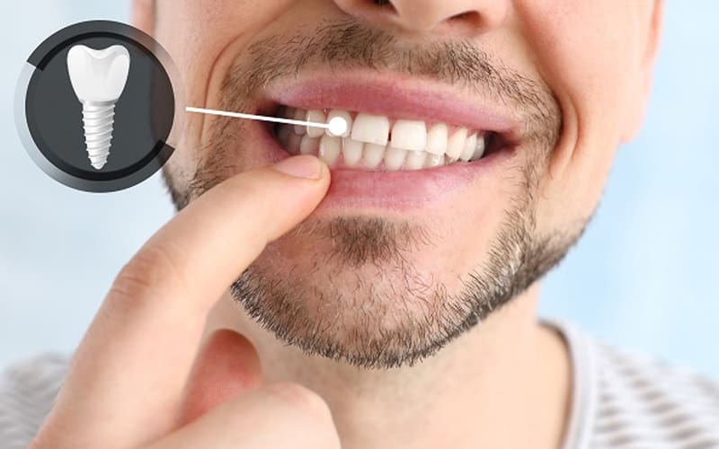 Exploring Dental Clinics in Turkey: What to Expect