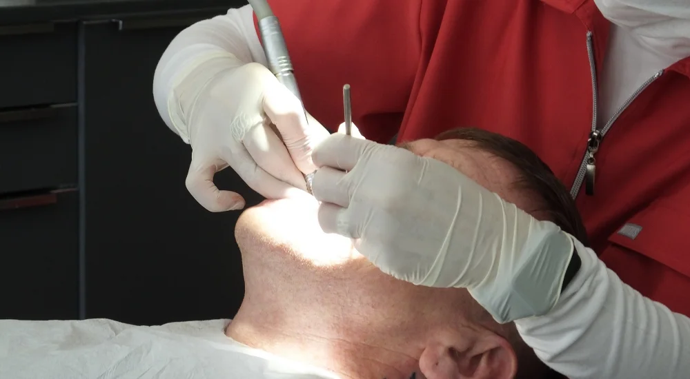 Root Canal Treatment Istanbul Turkey root canal treatment istanbul turkey