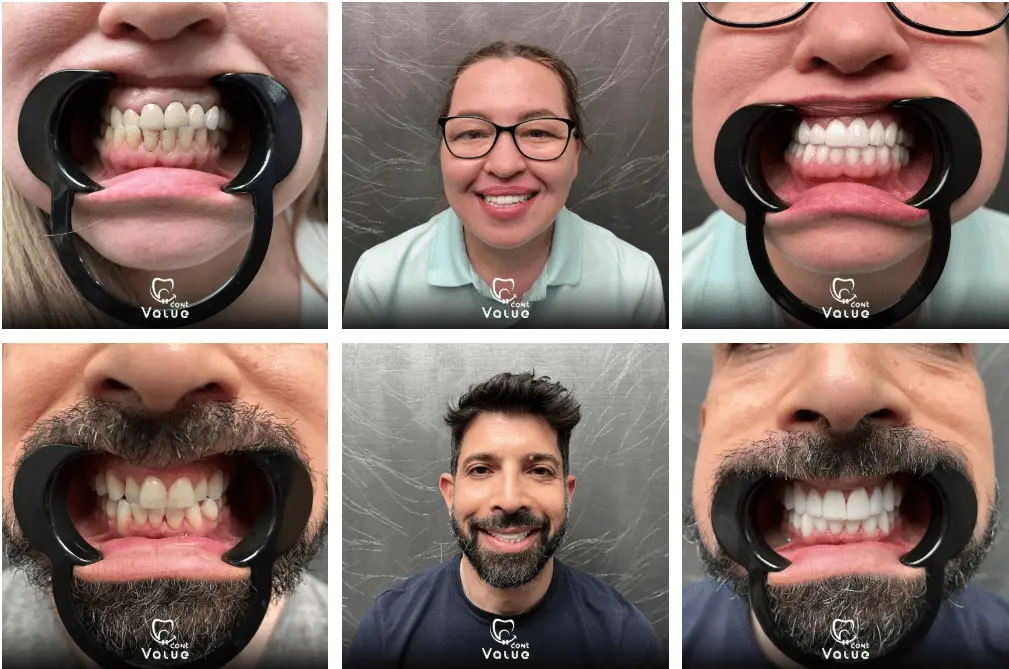 before-after-gallery