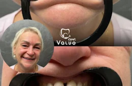 What to Expect: Your Complete Guide to Dental Tourism in Turkey