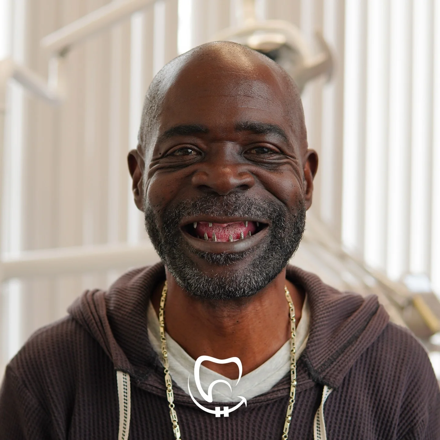 valuedent clinic full mouth dental implants in istanbul before